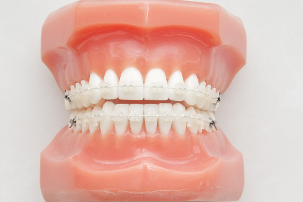 綾瀬亀有ロハス歯科＆矯正歯科の矯正歯科