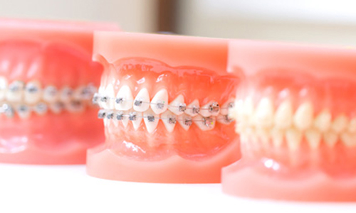 綾瀬亀有ロハス歯科＆矯正歯科の矯正歯科