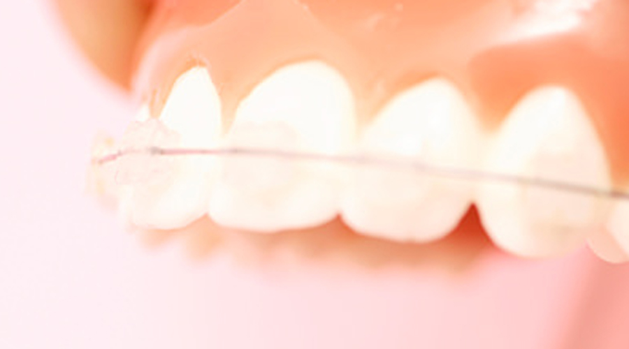 綾瀬亀有ロハス歯科＆矯正歯科の矯正歯科