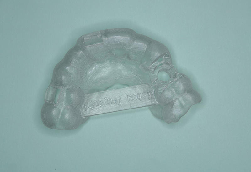 綾瀬亀有ロハス歯科＆矯正歯科のインプラント治療例