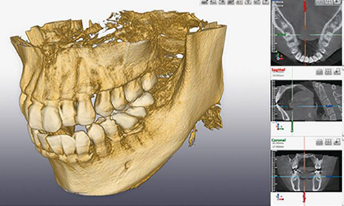 綾瀬亀有ロハス歯科＆矯正歯科の歯科用CT