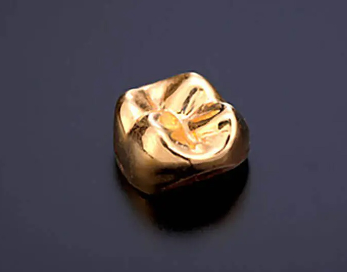 綾瀬亀有ロハス歯科＆矯正歯科の審美歯科