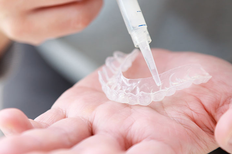 綾瀬亀有ロハス歯科＆矯正歯科でホワイトニング