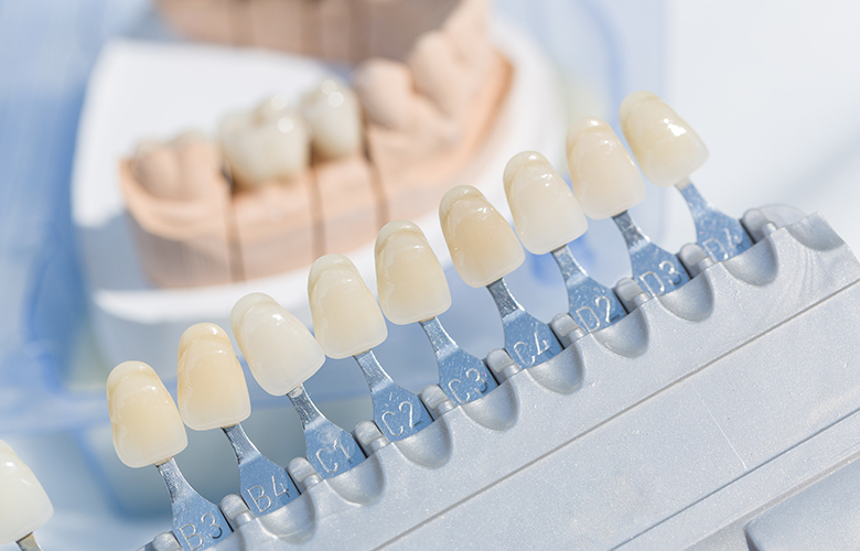 綾瀬亀有ロハス歯科＆矯正歯科の審美歯科