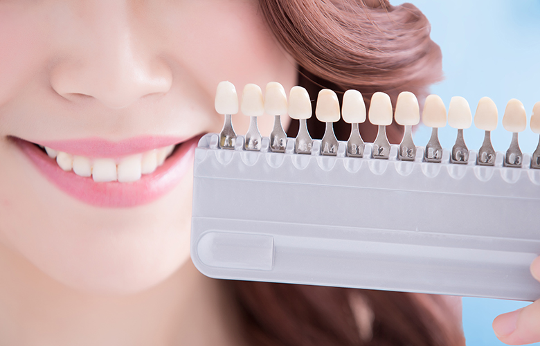 綾瀬亀有ロハス歯科＆矯正歯科でホワイトニング