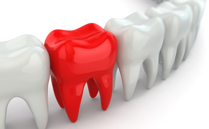 綾瀬亀有ロハス歯科＆矯正歯科で自家歯牙移植