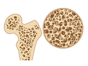 綾瀬亀有ロハス歯科＆矯正歯科の歯周病治療