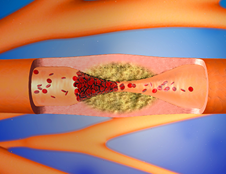 綾瀬亀有ロハス歯科＆矯正歯科の歯周病治療