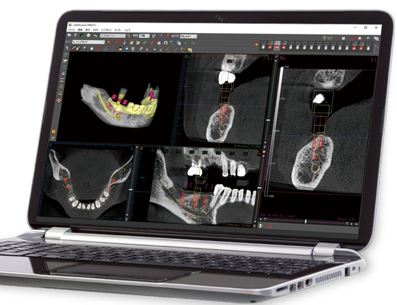 綾瀬亀有ロハス歯科＆矯正歯科のインプラント治療