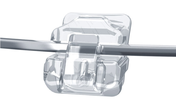 綾瀬亀有ロハス歯科＆矯正歯科の矯正歯科