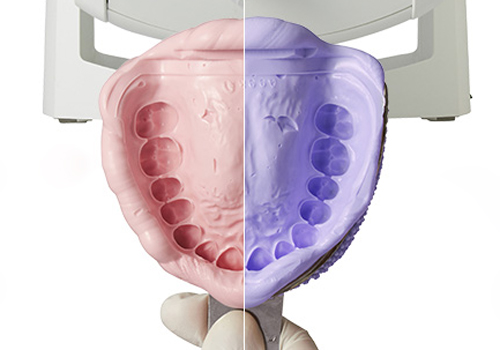 綾瀬亀有ロハス歯科＆矯正歯科の審美歯科