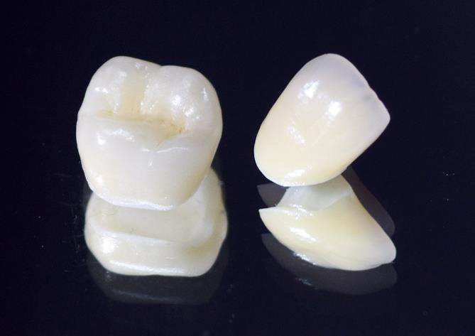 綾瀬亀有ロハス歯科＆矯正歯科の審美歯科